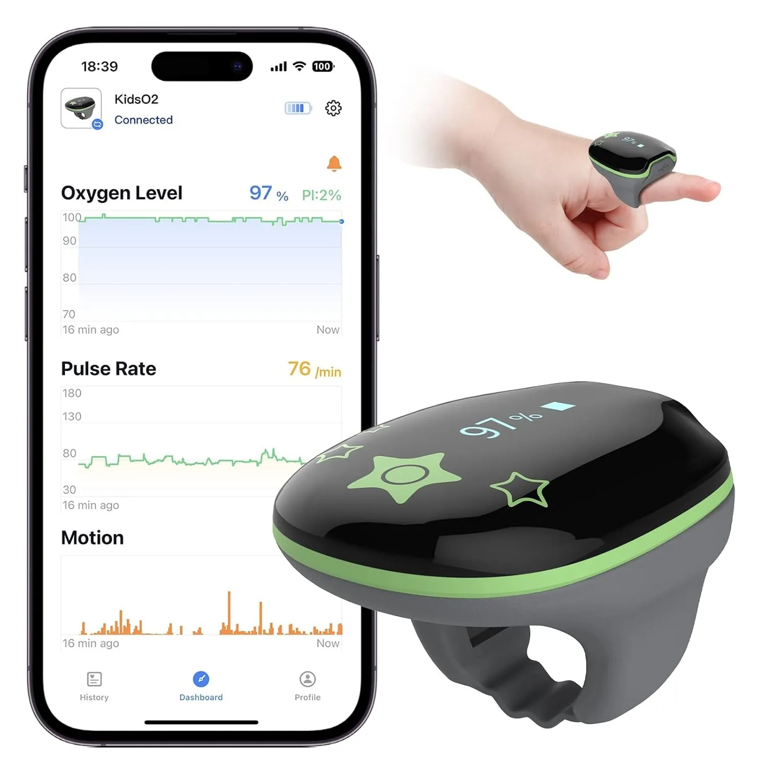 Viatom Pulsoximeter für Kinder, Tragbarer Finger Oximeter zur Kontinuierlichen Messung der Sauerstoffsättigung & Pulsfr…